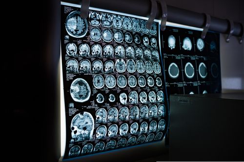 Die Zukunft der Neurotechnologien - Chancen und Risiken für unsere Gesellschaft